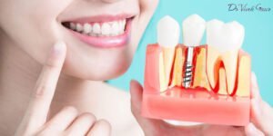 Read more about the article A Quick Guide To Same Day Implants And Full Mouth Reconstruction