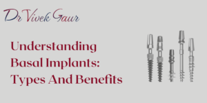 Read more about the article Understanding Basal Implants: Types And Benefits