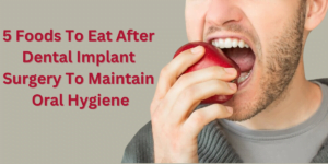 Read more about the article 5 Foods To Eat After Dental Implant Surgery To Maintain Oral Hygiene