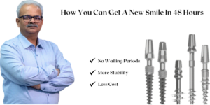 Read more about the article The Science Behind Immediate Loading Implants: How You Can Get A New Smile In 48 Hours
