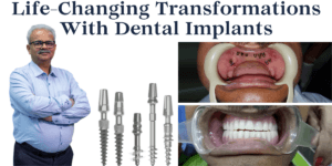 Read more about the article Patient Success Stories: Life Changing Transformations With Dental Implants 