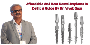 Read more about the article Affordable And Best Dental Implants In Delhi: A Guide By Dr. Vivek Gaur