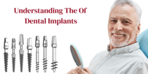 Read more about the article Understanding The Types Of Dental Implants: Which Is Right For You