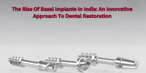 Read more about the article The Rise Of Basal Implants In India: An Innovative Approach To Dental Restoration