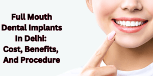 Read more about the article Full Mouth Dental Implants In Delhi: Cost, Benefits, And Procedure