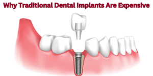 Read more about the article Why Traditional Dental Implants Are Expensive: The Hidden Costs Of Bone Grafting And Sinus Lifts