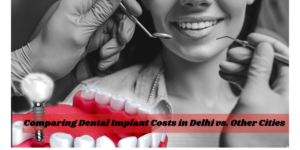 Read more about the article Comparing Dental Implant Costs in Delhi vs. Other Cities