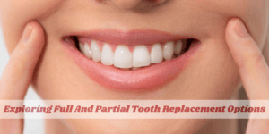 Read more about the article Exploring Full And Partial Tooth Replacement Options