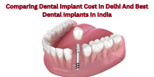 Read more about the article Comparing Dental Implant Cost  In Delhi And Best Dental Implants In India