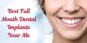 Read more about the article Best Full Mouth Dental Implants Near Me