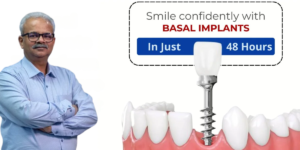 Read more about the article Dr. Vivek Gaur is The Basal Implant Expert Near Me – Cost, Procedure & Time