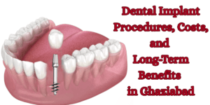 Read more about the article Dental Implant Procedures, Costs, and Long-Term Benefits in Ghaziabad