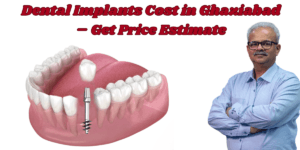 Read more about the article Dental Implants Cost in Ghaziabad – Get Price Estimate