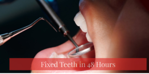 Read more about the article Fixed Teeth in 48 Hours – How Is This Possible?