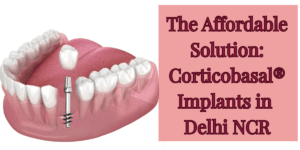 Read more about the article The Affordable Solution: Corticobasal® Implants in Delhi NCR