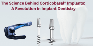 Read more about the article The Science Behind Corticobasal® Implants: A Revolution in Implant Dentistry