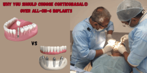 Read more about the article Dental Implant Surgery in Delhi:  Why You Should Choose Corticobasal® Over All-on-4 Implants
