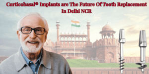 Read more about the article Why Corticobasal® Implants are The Future Of Tooth Replacement In Delhi NCR