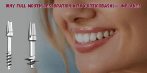 Read more about the article Why Full Mouth Restoration with Corticobasal® Implants Is a Smarter Investment