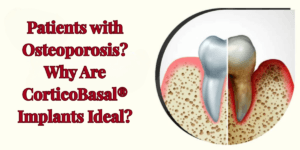 Read more about the article Patients with Osteoporosis? Why Are CorticoBasal® Implants Ideal?