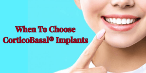 Read more about the article Single vs. Multiple Teeth Replacement: When to Choose CorticoBasal® Implants