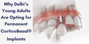 Read more about the article Why Delhi’s Young Adults Are Opting for Permanent CorticoBasal® Implants