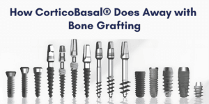 Read more about the article How CorticoBasal® Does Away with Bone Grafting