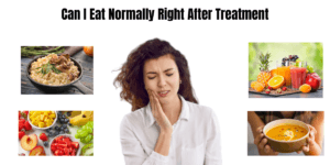 Read more about the article Can I Eat Normally Right After Treatment? What Foods Should I Avoid?
