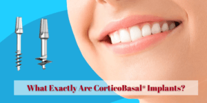 Read more about the article What Exactly Are CorticoBasal® Implants?