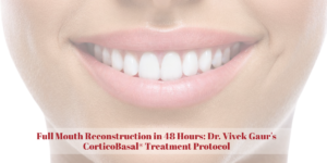 Read more about the article Full Mouth Reconstruction in 48 Hours: Dr. Vivek Gaur’s CorticoBasal® Treatment Protocol