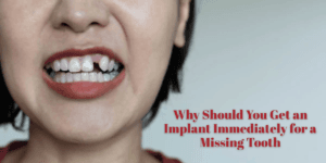 Read more about the article Why Should You Get an Implant Immediately for a Missing Tooth