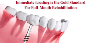 Read more about the article Fixed Teeth in 48 hours: Why Immediate Loading is the Gold Standard for Full-Mouth Rehabilitation