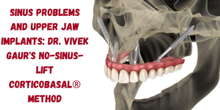 Read more about the article Sinus Problems And Upper Jaw Implants: Dr. Vivek Gaur’s No-Sinus-Lift CorticoBasal® Method