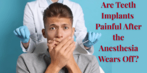 Read more about the article Are Teeth Implants Painful After The Anesthesia Wears Off?