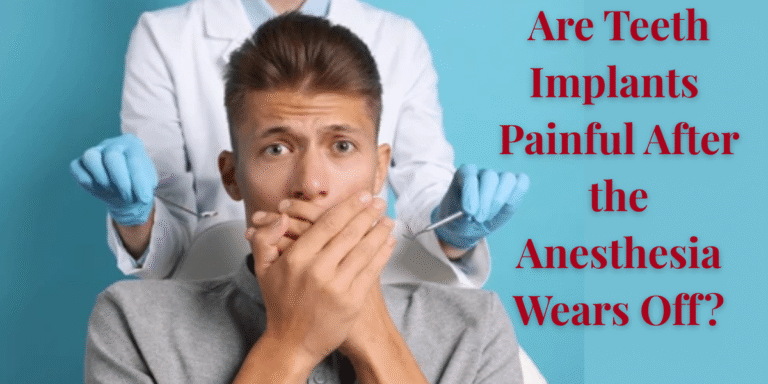 Read more about the article Are Teeth Implants Painful After The Anesthesia Wears Off?