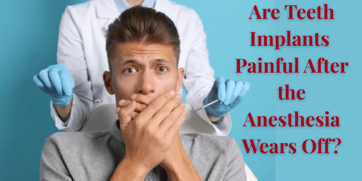 You are currently viewing Are Teeth Implants Painful After The Anesthesia Wears Off?