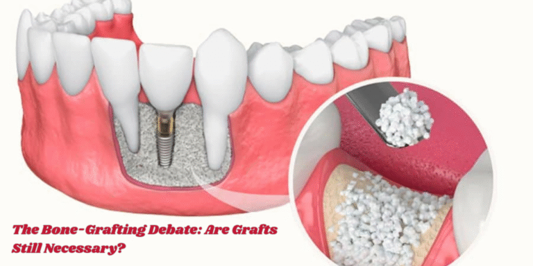 Read more about the article The Bone-Grafting Debate: Are Grafts Still Necessary?