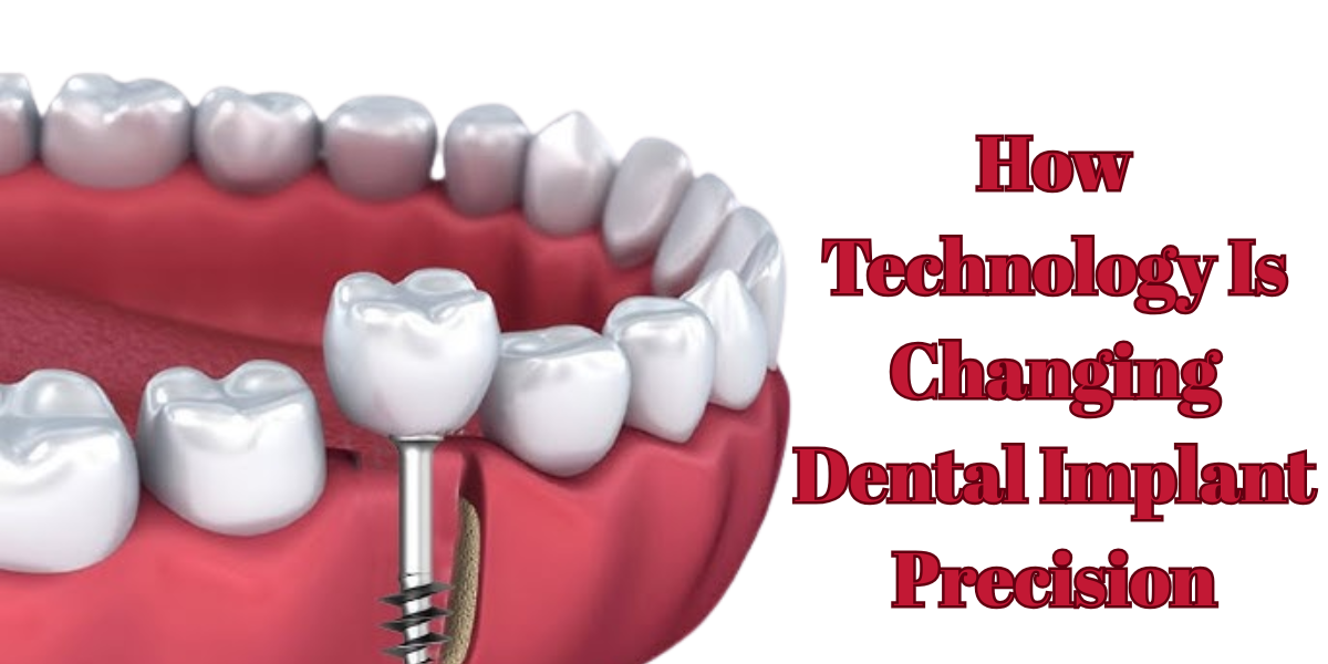 Read more about the article How Technology Is Changing Dental Implant Precision