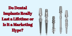 Read more about the article Do Dental Implants Really Last a Lifetime or Is It a Marketing Hype?