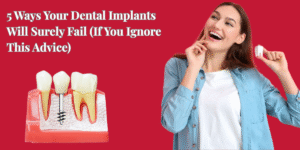 Read more about the article 5 Ways Your Dental Implants Will Surely Fail (If You Ignore This Advice)