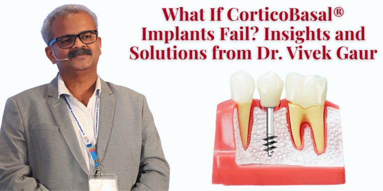 Read more about the article What If CorticoBasal® Implants Fail? Insights and Solutions from Dr. Vivek Gaur