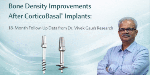 Read more about the article Bone Density Improvements After CorticoBasal® Implants: 18-Month Follow-Up Data from Dr. Vivek Gaur’s Research