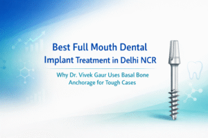 Read more about the article Best Full Mouth Dental Implant Treatment in Delhi NCR: Why Dr. Vivek Gaur Uses Basal Bone Anchorage for Tough Cases