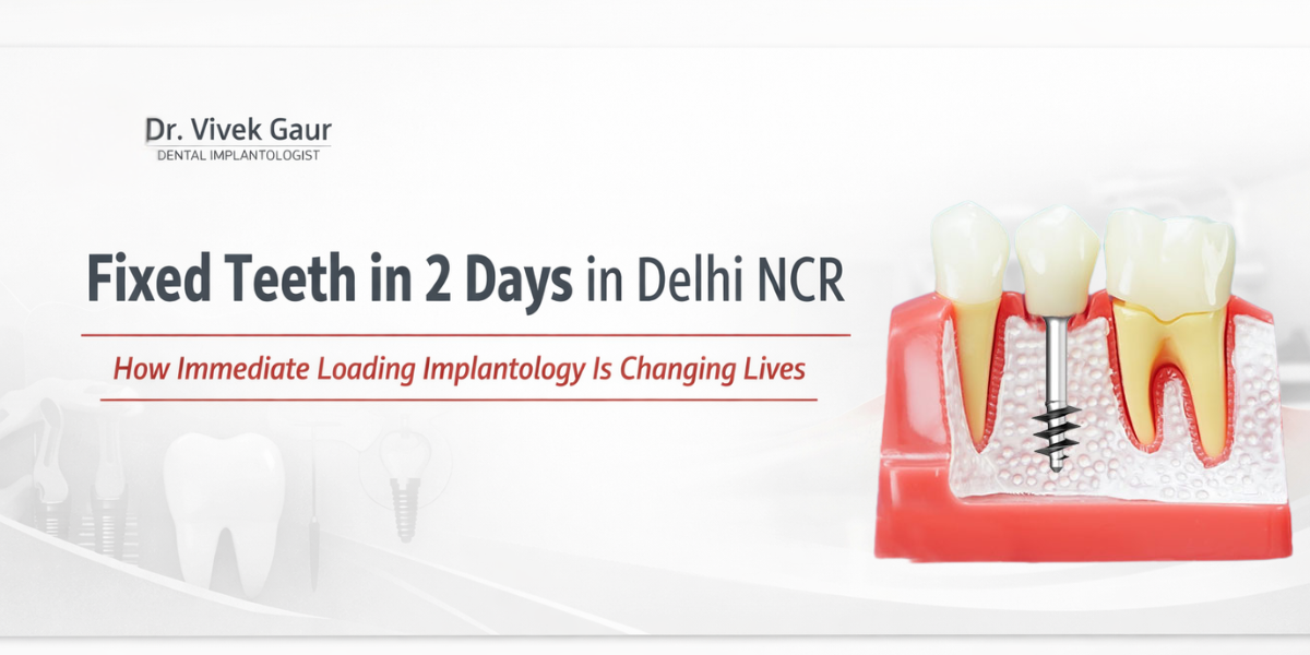 Read more about the article Fixed Teeth in 2 Days in Delhi NCR: How Immediate Loading Implantology Is Changing Lives