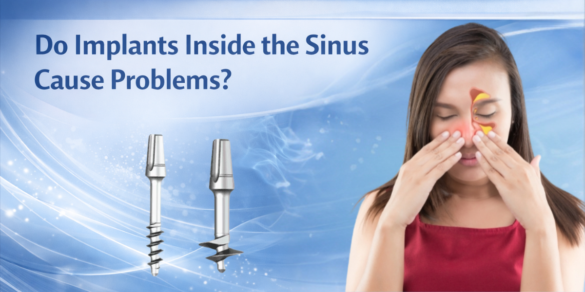 Read more about the article Do Implants Inside the Sinus Cause Problems?