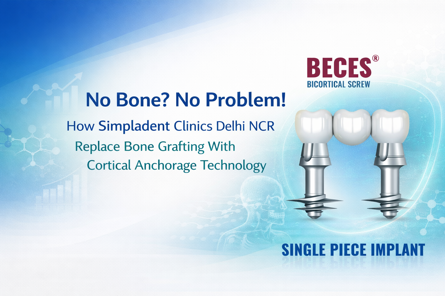 Read more about the article No Bone? No Problem! How Simpladent Clinics Delhi NCR Replace Bone Grafting With Cortical Anchorage Technology