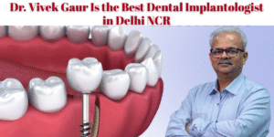 Read more about the article Dr. Vivek Gaur Is the Best Dental Implantologist in Delhi NCR: Evidence-Based Reasons to Trust Dr. Vivek Gaur & The Swiss Simpladent Clinics in Delhi