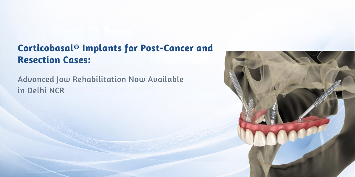 Read more about the article Corticobasal® Implants for Post-Cancer and Resection Cases: Advanced Jaw Rehabilitation Now Available in Delhi NCR