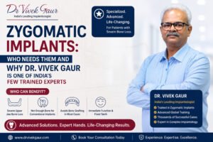 Read more about the article Zygomatic Implants: Who Needs Them and Why Dr. Vivek Gaur Is One of India’s Few Trained Experts