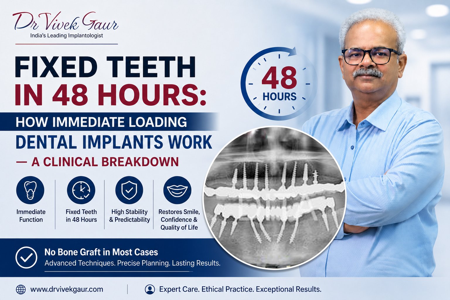Read more about the article Fixed Teeth in 48 Hours: How Immediate Loading Dental Implants Work — A Clinical Breakdown